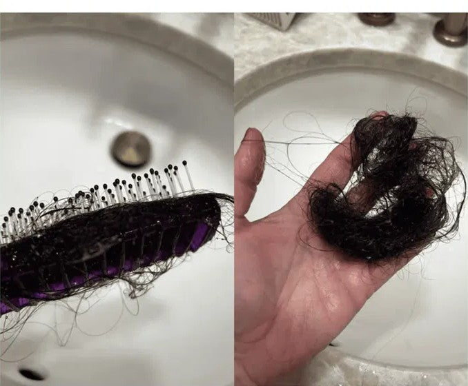 Hairbrush and handful of shed hair in the sink, showing hair loss on GLP-1
